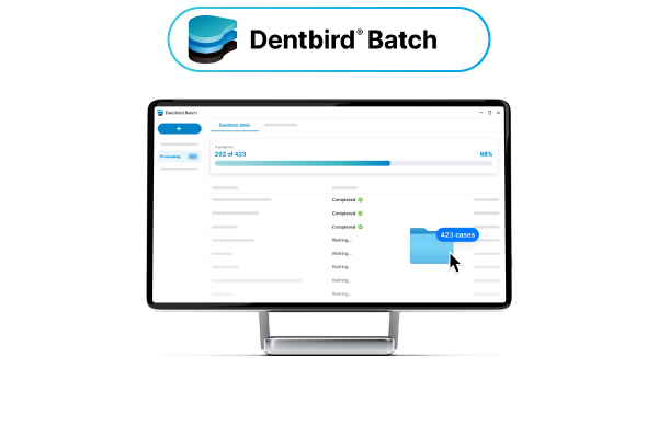 Dentbird Batch機能