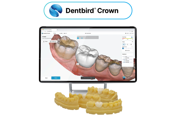 Dentbird Crown機能